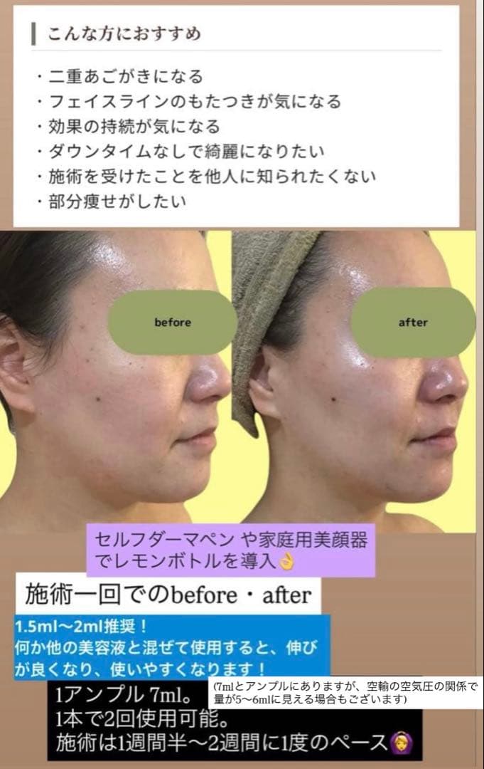 はる　レモン美容液×3